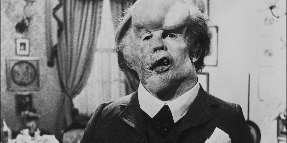 The elephant man hotsell